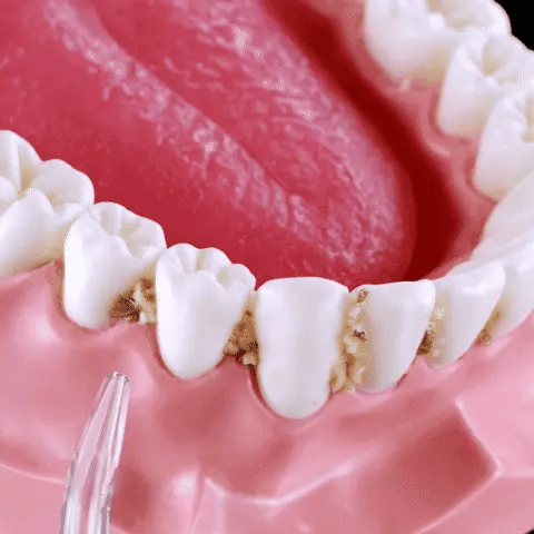 Irrigateur Oral Portable Sans Fil