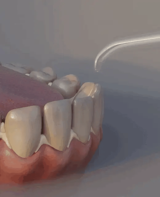 Irrigateur Oral Portable Sans Fil